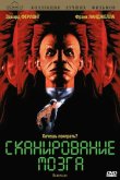 Сканирование мозга 1994
